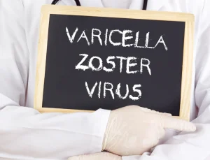 doctor with sign reading varicella zoster virus